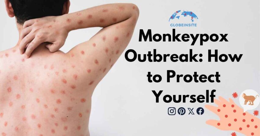 Monkeypox Outbreak: How to Protect Yourself